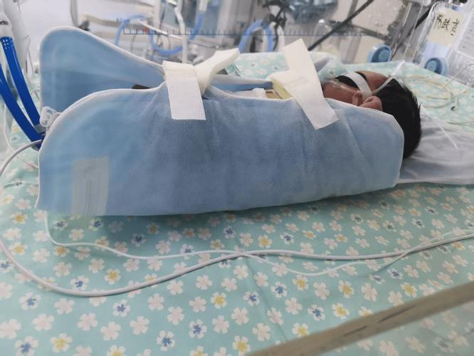 亞低溫治療設備 守護HIE新生兒腦功能的生命防線——錦醫一院專業應用與監護治療設備批發洞察